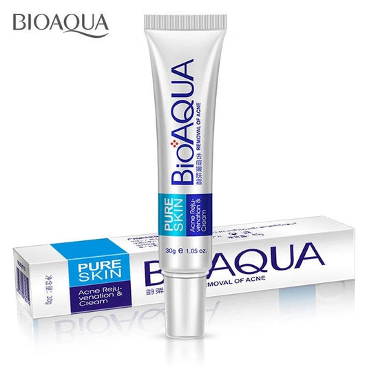 Acne Removal Cream – Anti Pimple & Dark Spot Treatment for Clear Skin