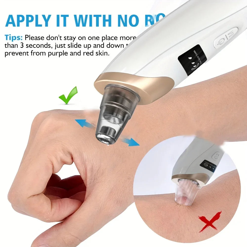 Electric Blackhead Remover Vacuum – Pore Cleaner & Acne Suction Device (5 Heads)